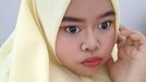 Penampilan Kekeyi Setelah Filler Hidung Penampilan Kekeyi Setelah Filler Hidung