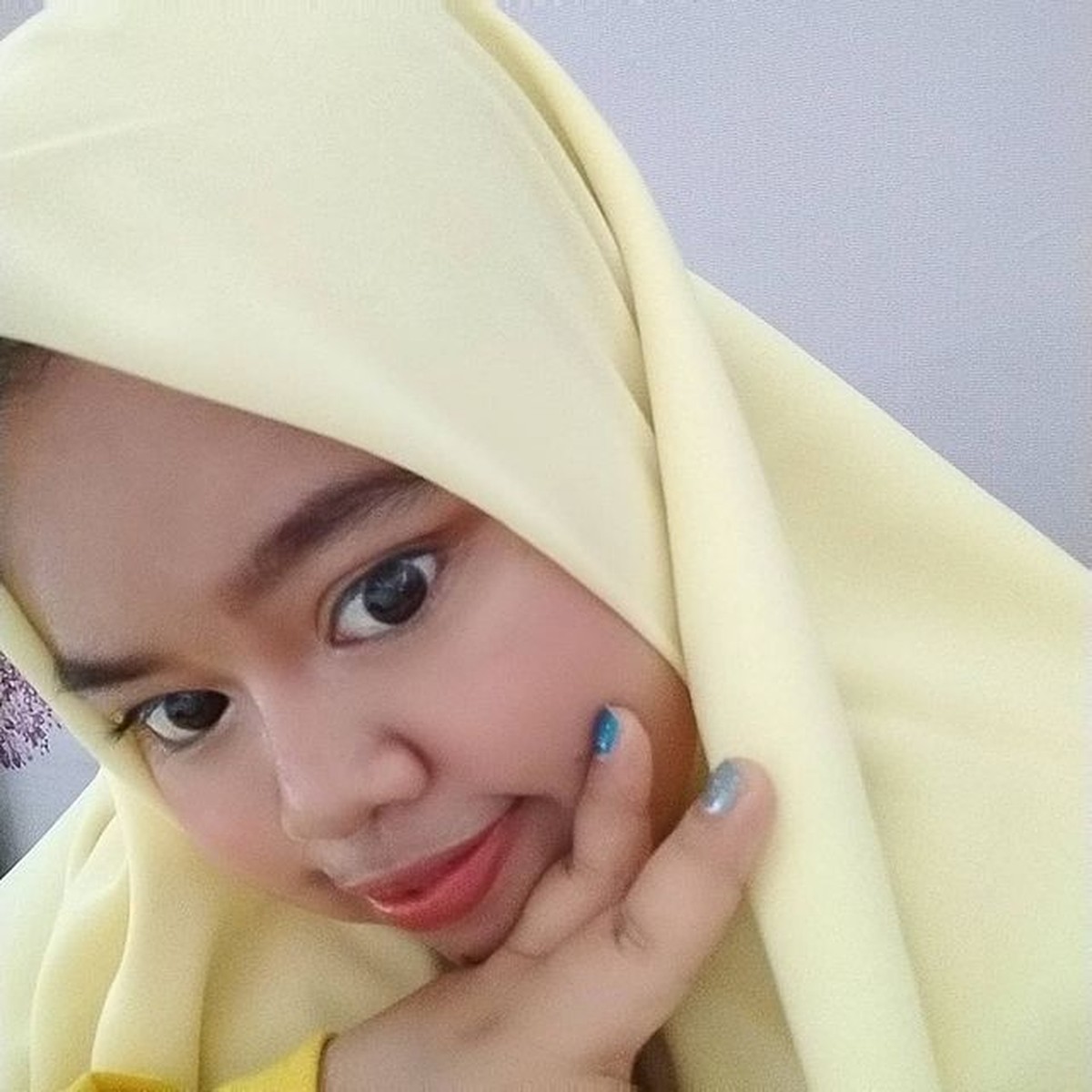 Penampilan Kekeyi Setelah Filler Hidung