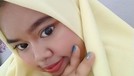 Penampilan Kekeyi Setelah Filler Hidung Penampilan Kekeyi Setelah Filler Hidung
