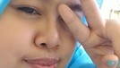 Penampilan Kekeyi Setelah Filler Hidung Penampilan Kekeyi Setelah Filler Hidung