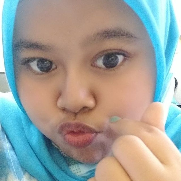Penampilan Kekeyi Setelah Filler Hidung Penampilan Kekeyi Setelah Filler Hidung