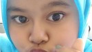 Penampilan Kekeyi Setelah Filler Hidung Penampilan Kekeyi Setelah Filler Hidung