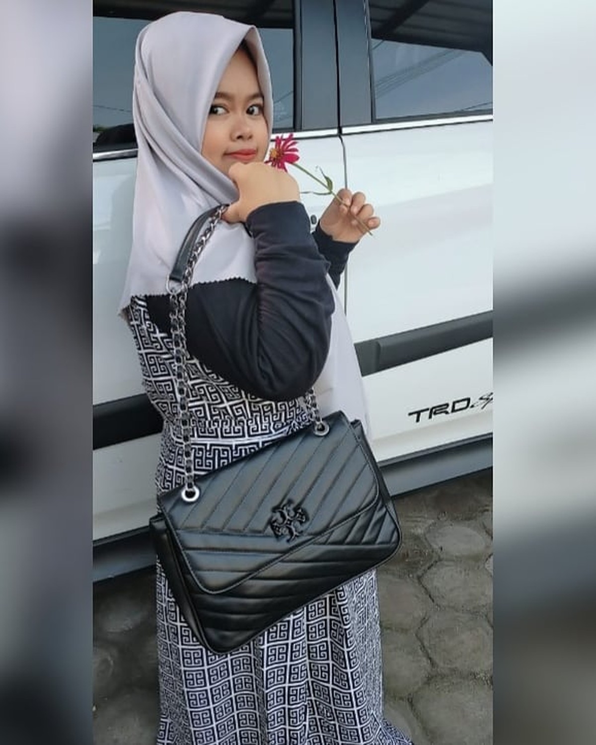 Penampilan Kekeyi Setelah Filler Hidung