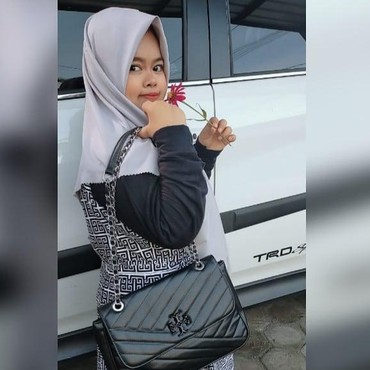 Inilah Penampilan Kekeyi Setelah Filler Hidung