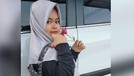 Penampilan Kekeyi Setelah Filler Hidung Penampilan Kekeyi Setelah Filler Hidung