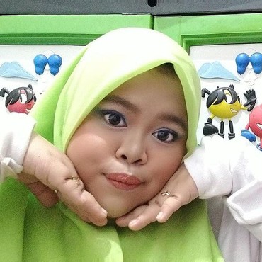 Ini Alasan Kekeyi Pilih Lakukan Filler Hidung