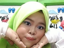 Punya Hidung Baru Hasil Filler, Kekeyi: Aku Suka Cekali