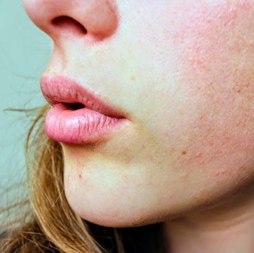 img-title Pelajari 5 Cara Memperbaiki Skin Peeling yang Home-Friendly