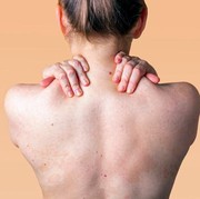 7 Cara Mudah Mengatasi Jerawat di Punggung