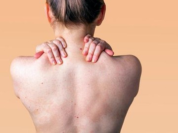 Jerawat Punggung Gatal Begini Cara Mengatasinya Halaman 2