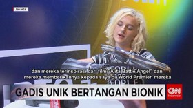 VIDEO: Gadis Unik Bertangan Bionik