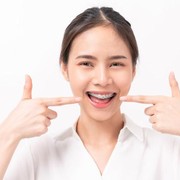 Bingung Pilih Warna Behel? Coba 6 Tips Ini Ladies