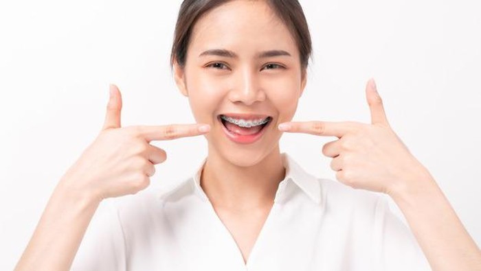 Bingung Pilih Warna Behel? Coba 6 Tips Ini Ladies