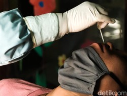 Kenapa Alat Tes Swab COVID-19 Murah Dijual Online? Hati-hati, Ini Pesan Dokter