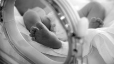 DAMPAK BAYI LAHIR PREMATUR