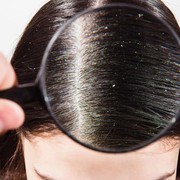 BeauPicks: Rekomendasi 5 Shampoo Anti Ketombe, Dijamin Ampuh!