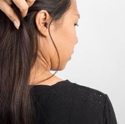 Kenali Penyebab Serta Cara Mengatasi Kulit Kepala Gatal dan Ketombe Membandel