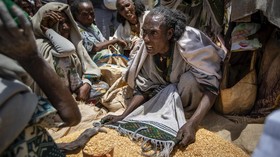FOTO: Bayang-bayang Hitam Kelaparan di Ethiopia
