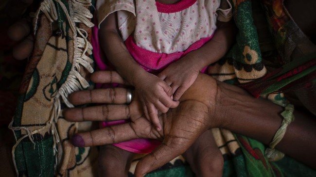 FOTO: Bayang-bayang Hitam Kelaparan di Ethiopia