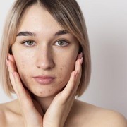 Ketahui 8 Cara untuk Mengatasi Masalah Kulit 'Indoor Face'