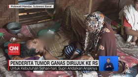 VIDEO: Penderita Tumor Ganas Dirujuk Ke RS