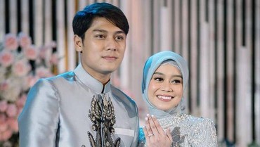 Pandangan Berbeda Robby Purba soal Lesti Kejora yang Jadi Sorotan