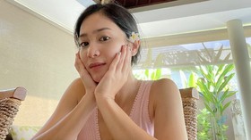 Bunga Zainal Sebut Masuk RS karena Infeksi Darah
