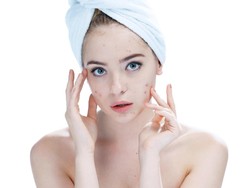 6 Jenis Jerawat dan Cara Mengatasinya, Acne Fighter Harus Tahu!