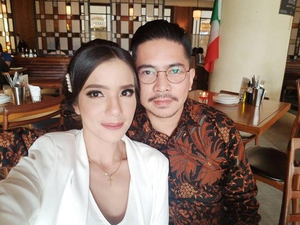 Mata Sheila Marcia Lebam, Ini Respons Suami saat Dicurigai KDRT