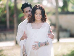 Peluk dan Cium Suami, Sheila Marcia Tegaskan Mata Lebam Bukan KDRT