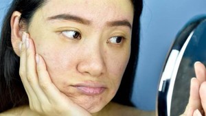 Rekomendasi Produk Skincare AHA BHA Paling Ampuh Buat Angkat Sel Kulit Mati