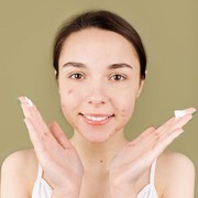 Kenapa Setiap Haid Muncul Jerawat? Ini Alasannya!