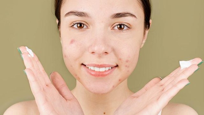 Kenapa Setiap Haid Muncul Jerawat? Ini Alasannya!