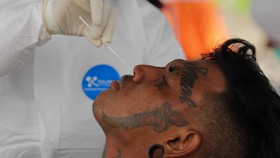 Kematian Bertambah 551 Orang, Kasus Covid Aktif Jadi 217.590