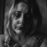 Bipolar Personality Disorder, Gangguan Kepribadian yang Gejalanya Bisa Kamu Deteksi