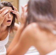 Punya Jerawat di Dahi? Ini Penyebab dan Cara Mengatasinya