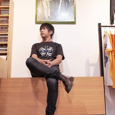 Rian D'MASIV Kena Semburan Api saat Manggung, Begini Kondisinya