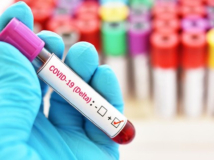 7 Fakta COVID-19 Varian Delta, Lebih Menular dan Berbahaya Bagi Ibu Hamil