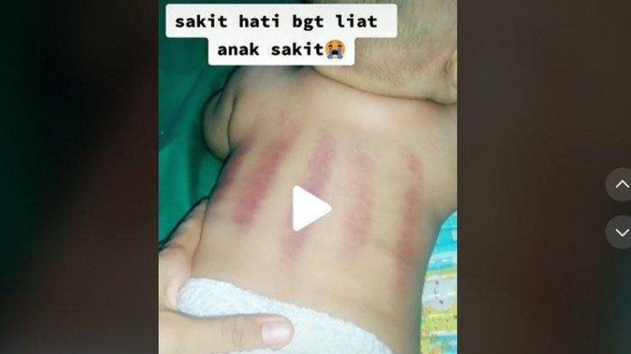 Viral bayi dikerok Viral bayi dikerok