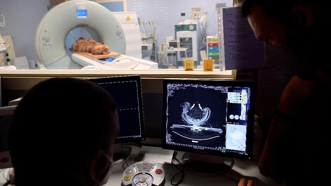 FOTO: Italia Pakai CT Scan untuk Ungkap Rahasia Mumi Mesir