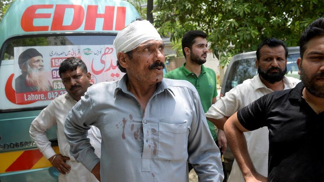FOTO: Ledakan Bom Bunuh Balita di Lahore Pakistan