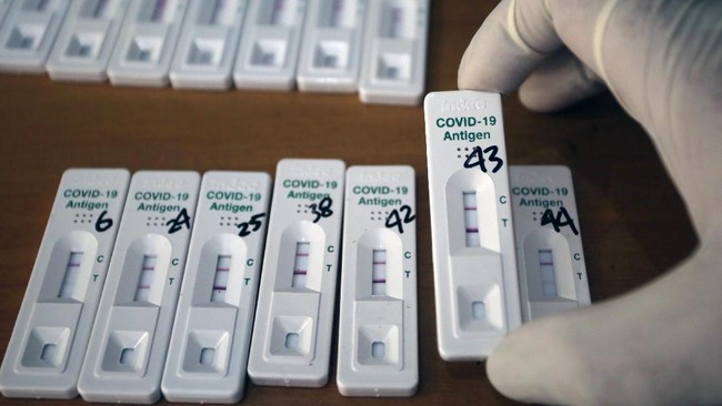 Kemenkes menyebut akan memberikan sosialisasi ke pemerintah daerah untuk meningkatkan jumlah testing seperti yang dimaksud Kemenkes, bukan sebatas screening.