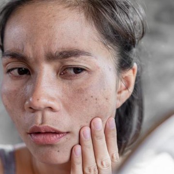 img-title Kulit Kinclong Bebas Kusam di Akhir Minggu, Ini Rahasianya!