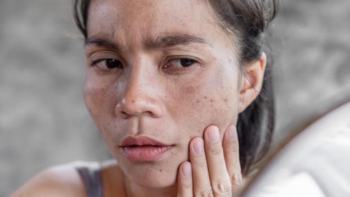 Kulit Kinclong Bebas Kusam di Akhir Minggu, Ini Rahasianya!