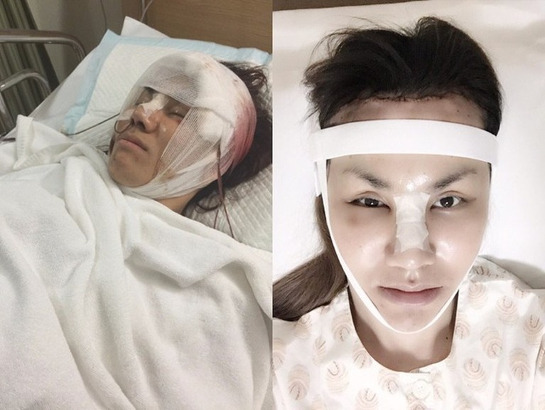 Perjalanan Transgender Cantik Sebelum & Sesudah Dinikahi Berondong Transgender cantik yang bernama Bow sedang viral karena resmi menikah dengan seorang berondong. Yuk kita intip transformasinya!