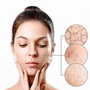 Kulit Dehidrasi Harus Bagaimana? Simak Kiatnya di Sini!