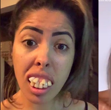 Heboh Transformasi Wanita Usai Dinikahi Dokter Gigi, Sukses Bikin Emosi