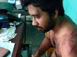 Kisah Dokter Dianiaya Keluarga Pasien COVID-19 yang Meninggal
