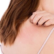 Penyebab Eksim dan Kandungan Terbaik dalam Skincare untuk Mengobatinya, Dicoba Yuk!