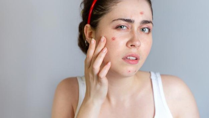 5 Merk Pembersih Jerawat Paling Mujarab untuk Hempas Jerawat Membandel